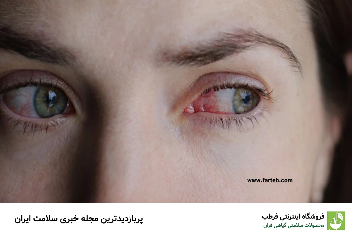 سکته چشمی چیست؟ بررسی علل، علائم و خطر های آن