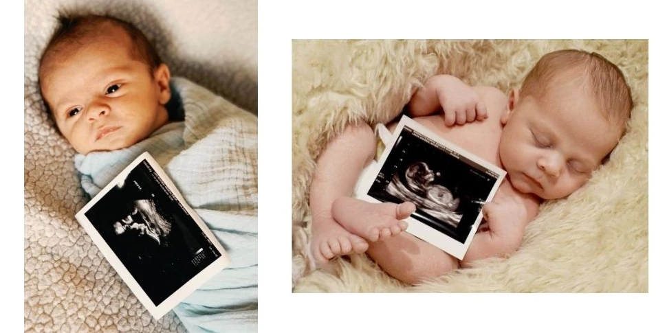 عکس دختر بچه چشم آبی