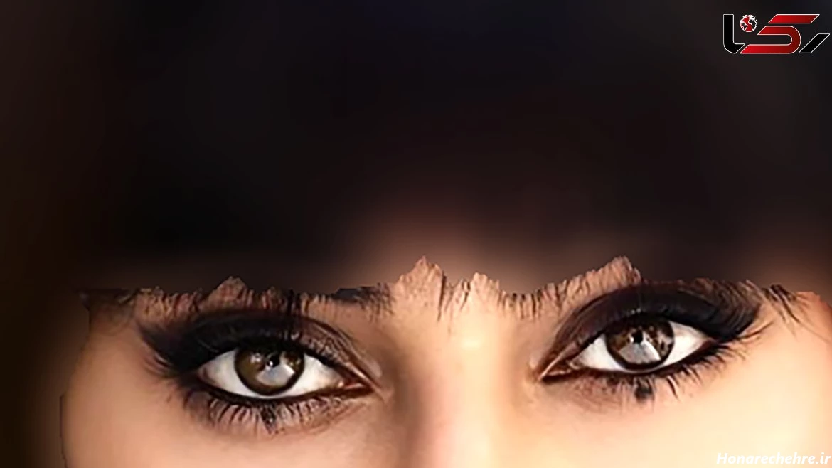 چشم آهویی انسان