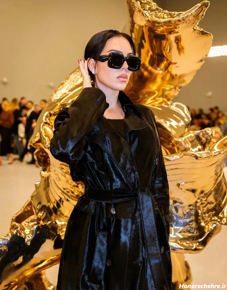 جورجینا رودریگز قبل از عمل