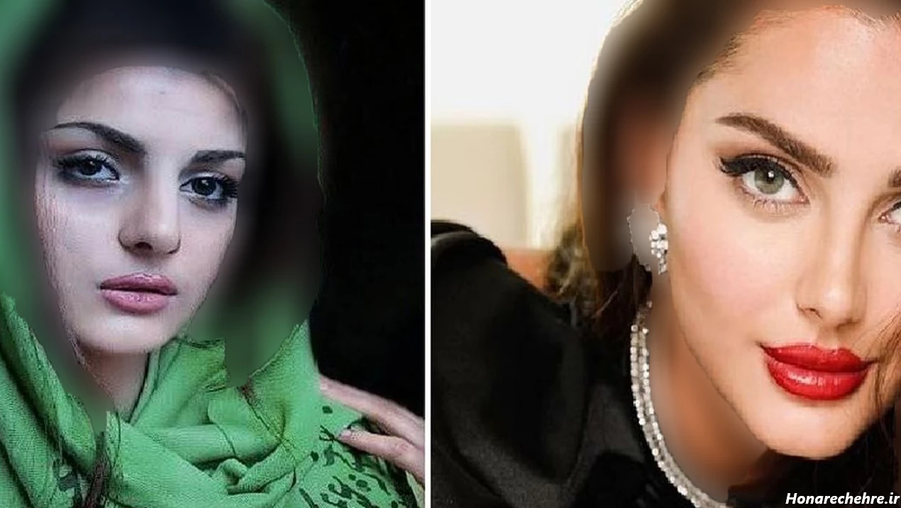 قبل و بعد از زیباترین دختر ایران! / چهره واقعی مه لقا جابری ...