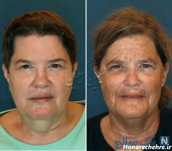 عکس پروفایل خنده دار بدون متن