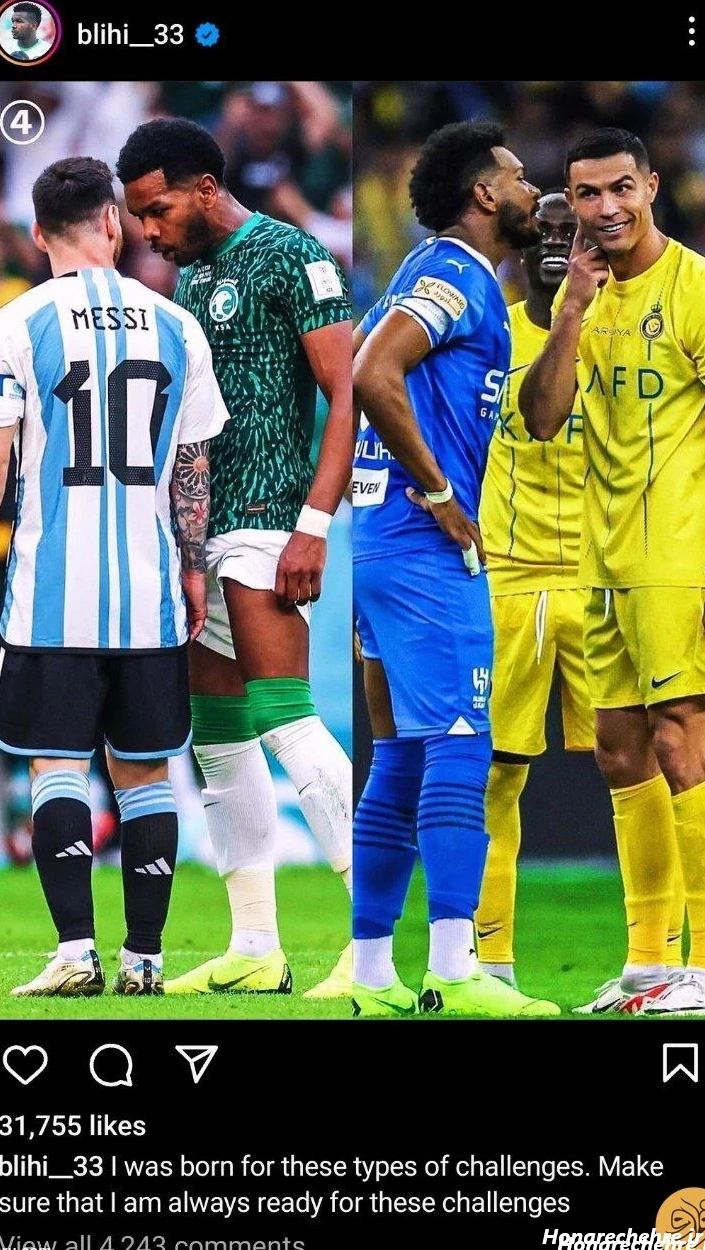 عکس مسی کچل خنده دار