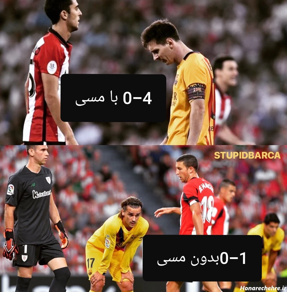 عکس مسی کچل خنده دار