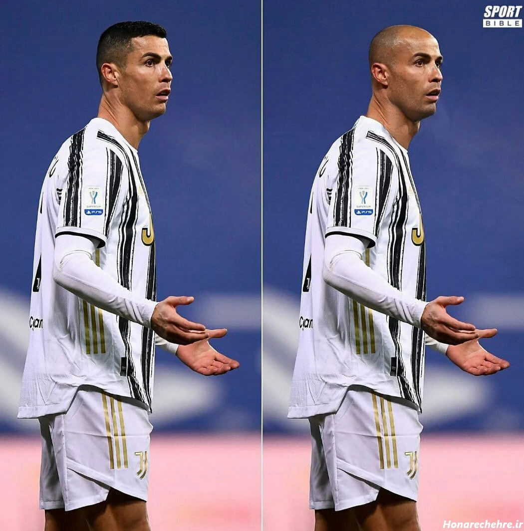 عکس مسی کچل بی دندون