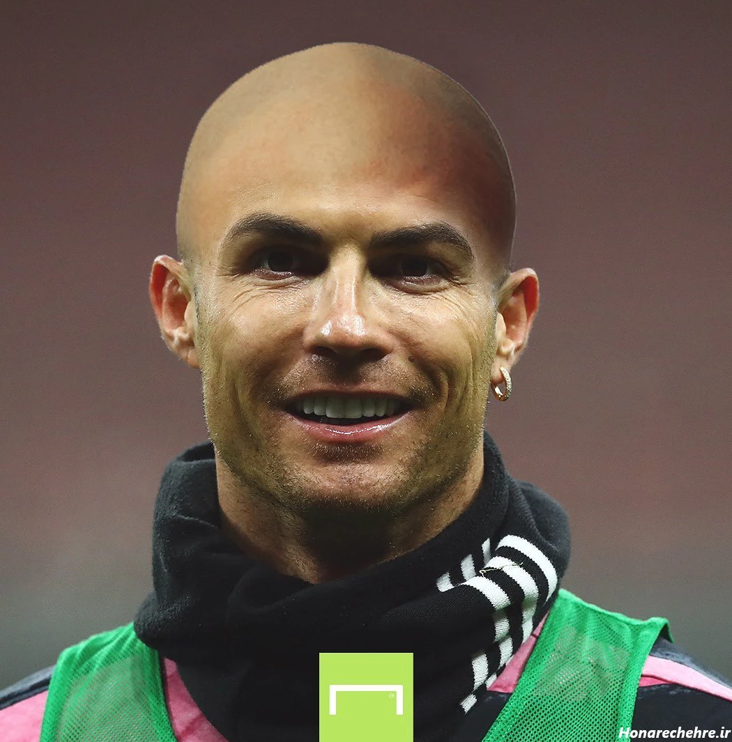 عکس مسی کچل بی دندون