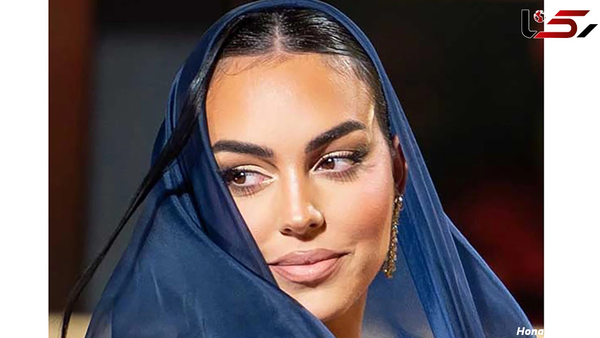 جورجینا رودریگز قبل از عمل