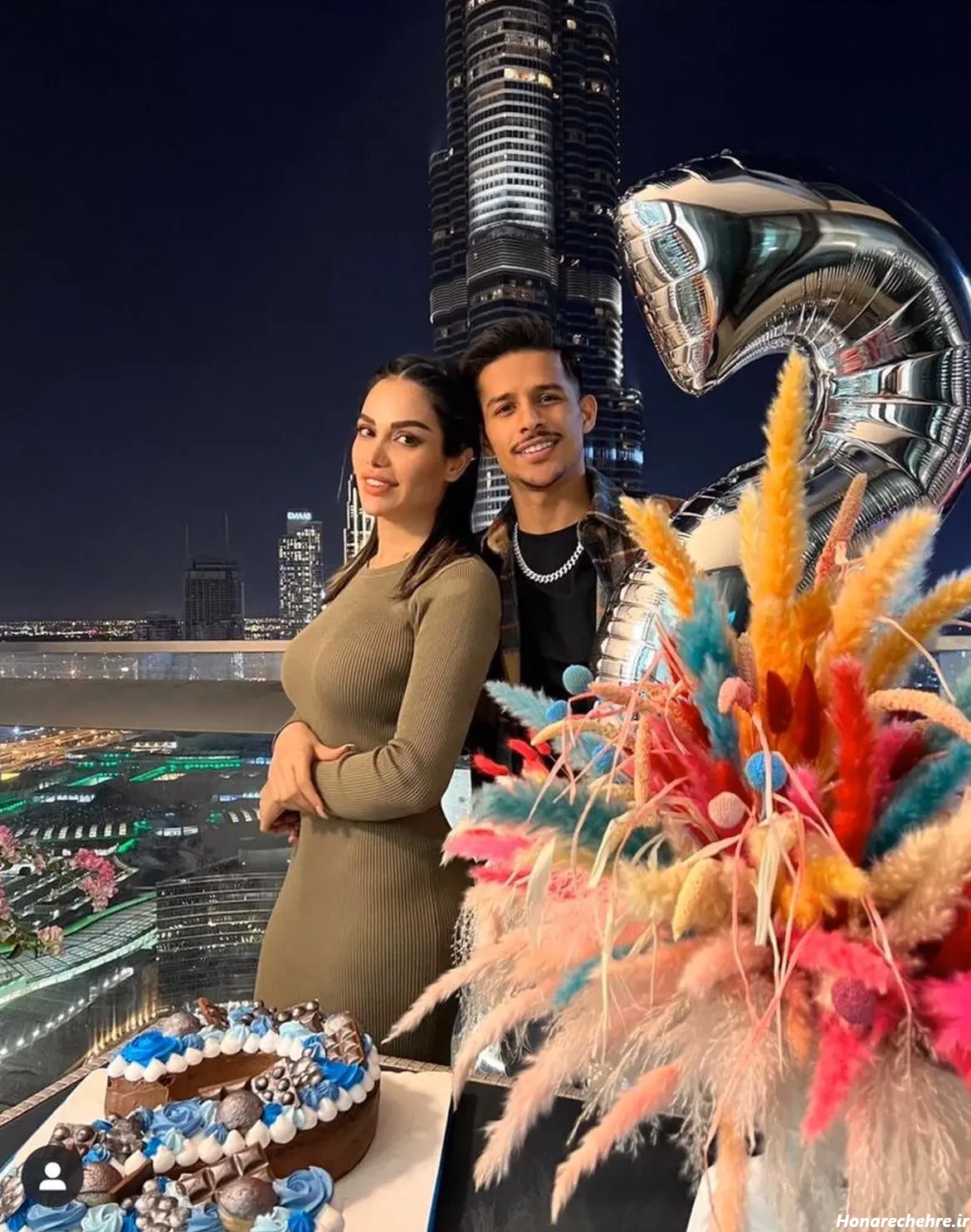 جورجینا رودریگز قبل از عمل