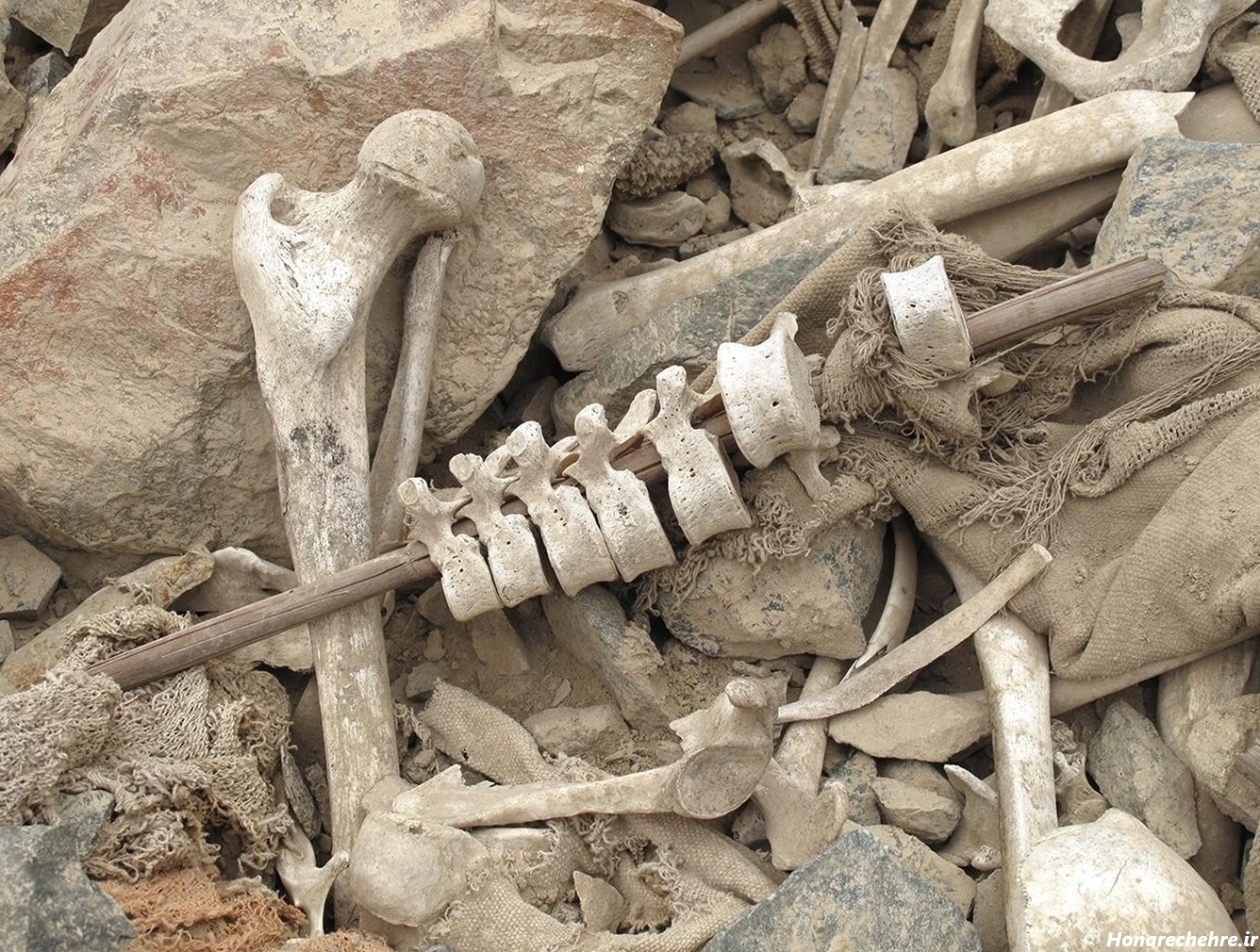 عکس اسکلت واقعی انسان