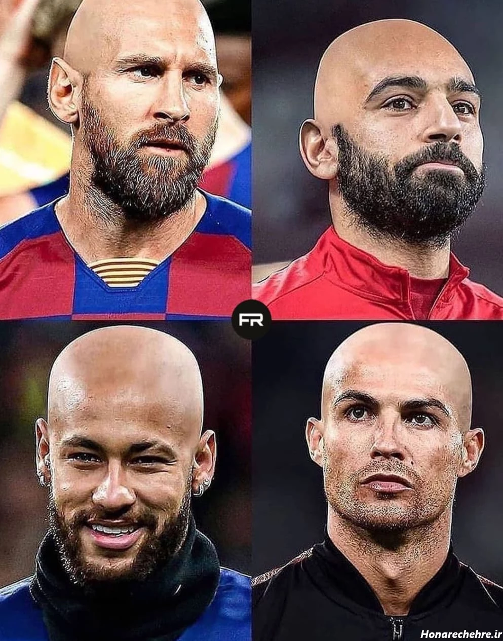 عکس مسی کچل بی دندون