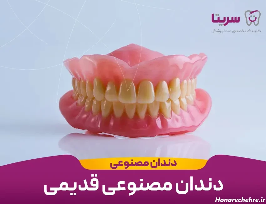 دندان مصنوعی قدیمی