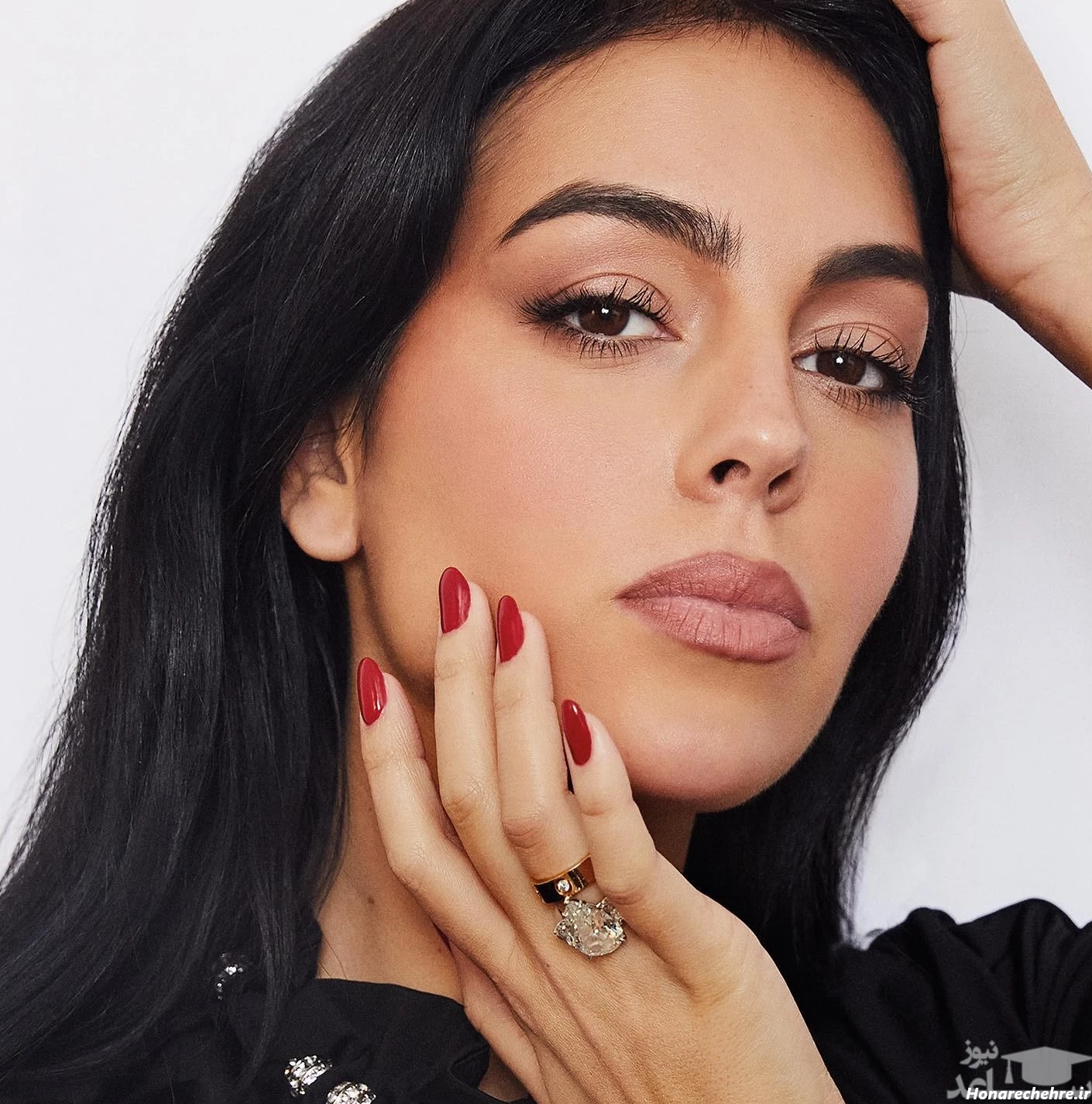 جورجینا رودریگز قبل از عمل