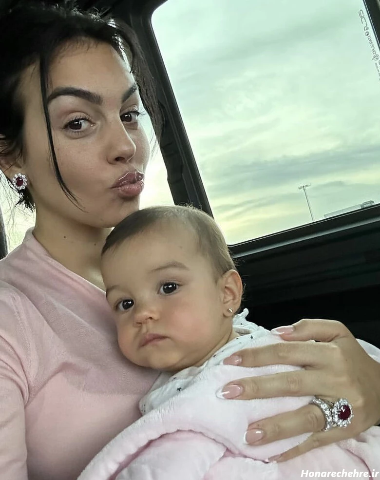 جورجینا رودریگز قبل از عمل