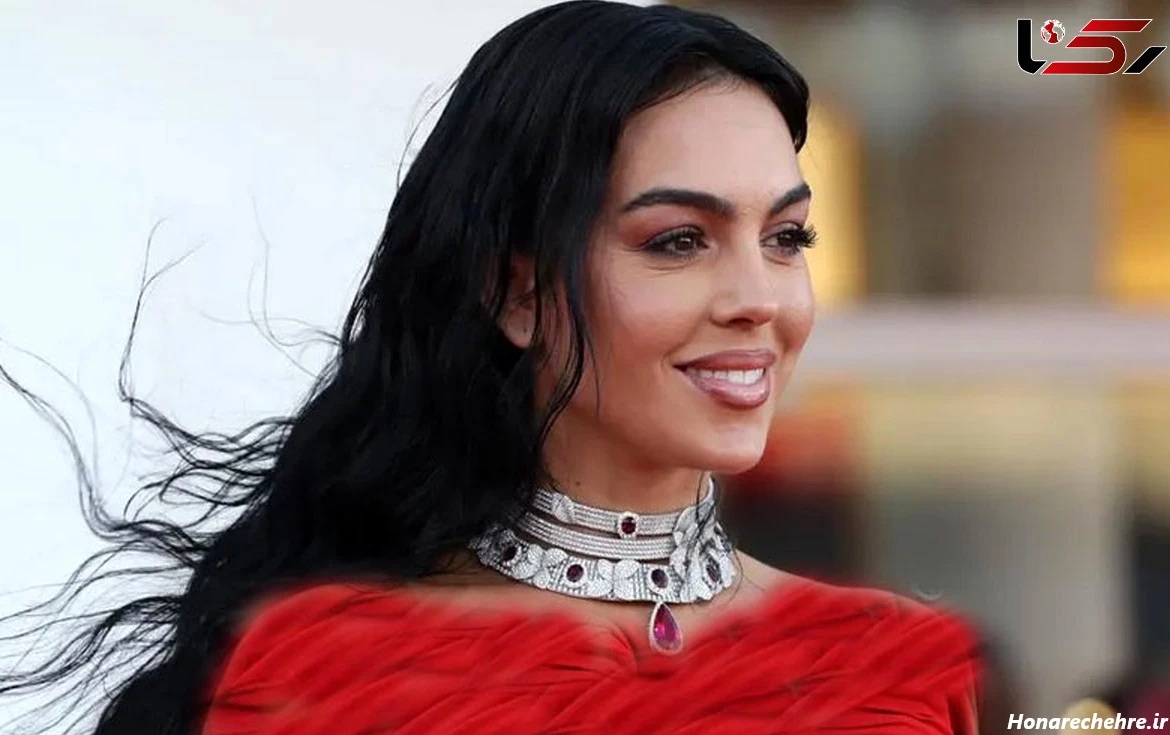 جورجینا رودریگز قبل از عمل